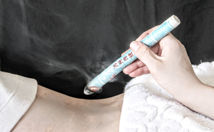 acupuntura the kine hub