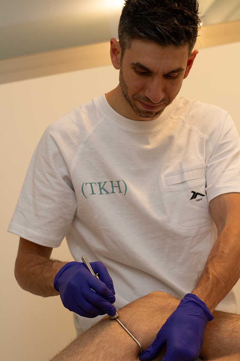 Javier Vela, fisioterapeuta y osteópata de The Kine Hub, aplicando punción seca en la pierna de un paciente